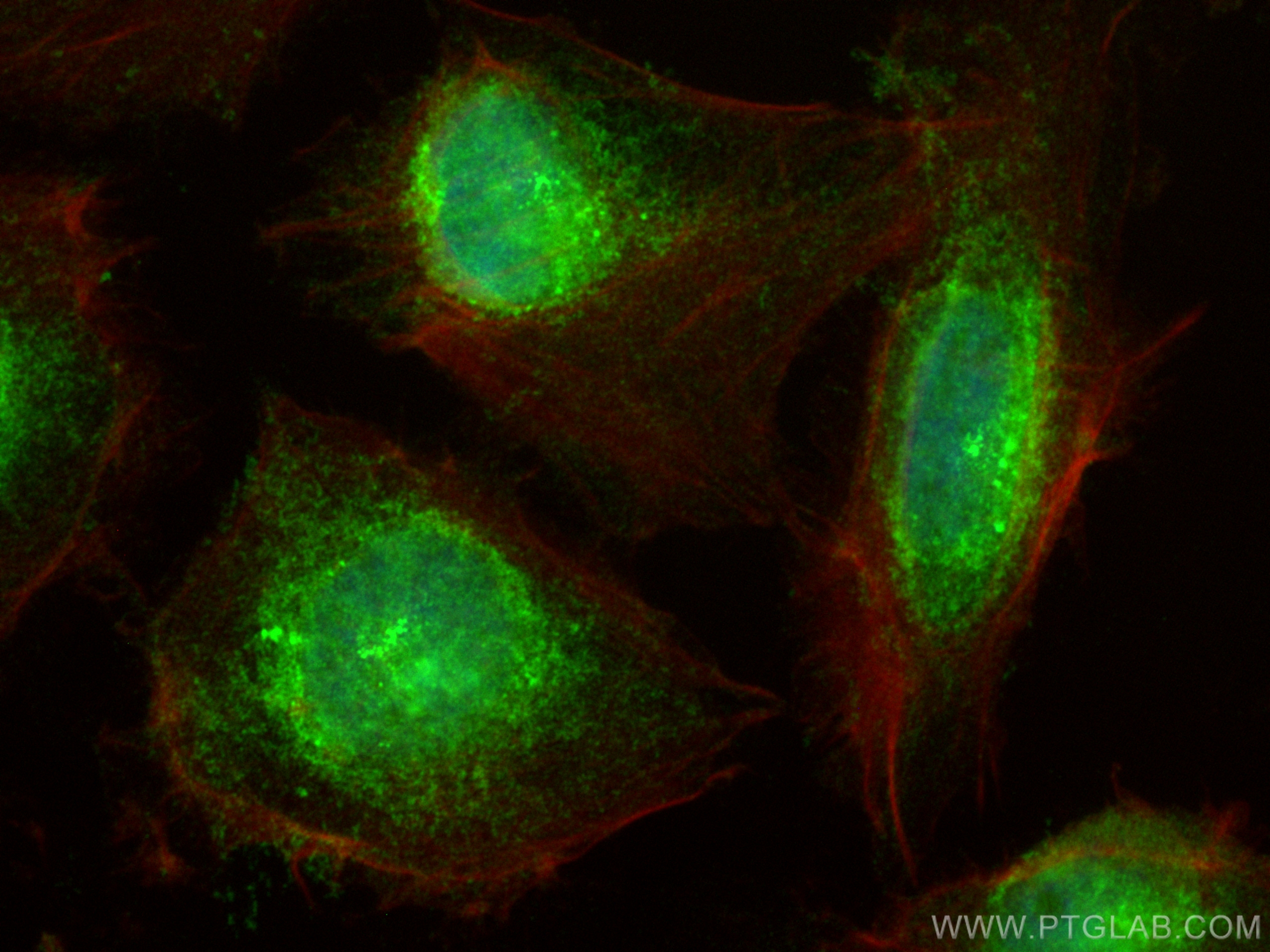 Immunofluorescence (IF) / fluorescent staining of U-251 cells using Casein Kinase 1 Delta Polyclonal antibody (14388-1-AP)