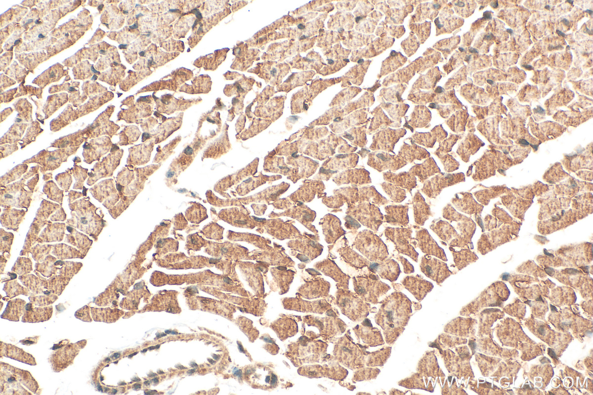 Immunohistochemistry (IHC) staining of mouse heart tissue using Casein Kinase 1 Delta Polyclonal antibody (14388-1-AP)