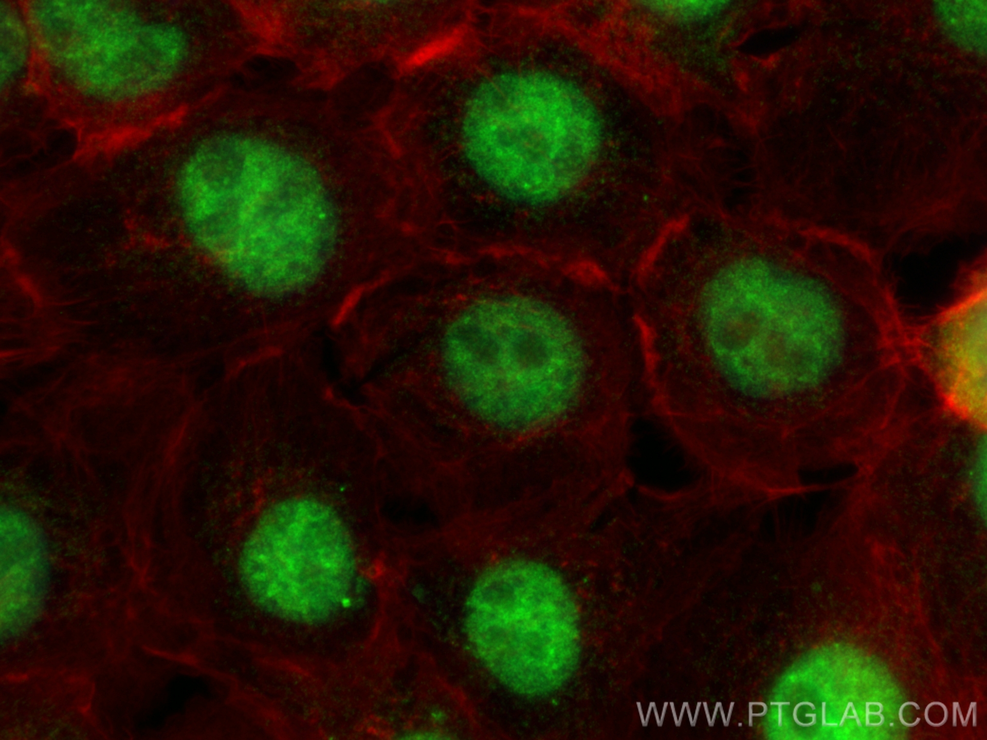 Immunofluorescence (IF) / fluorescent staining of A431 cells using CSNK2A1 Monoclonal antibody (68200-1-Ig)