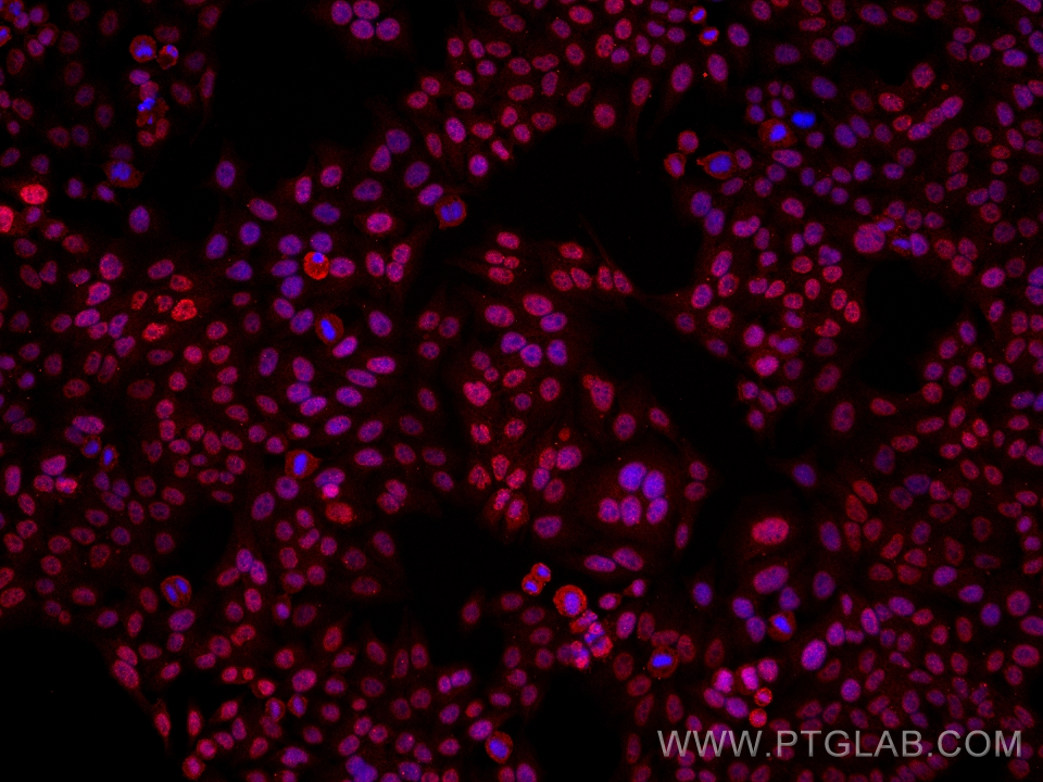 Immunofluorescence (IF) / fluorescent staining of HepG2 cells using CSNK2A1 Monoclonal antibody (68200-1-Ig)