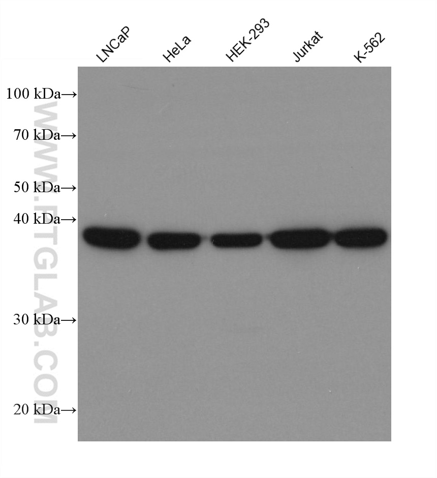 CSNK2A1