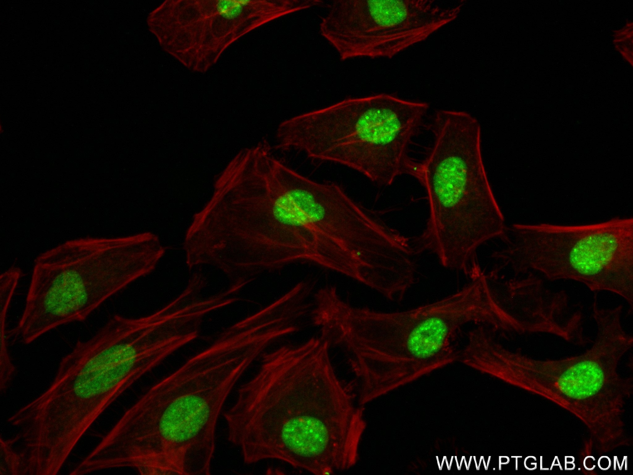 Immunofluorescence (IF) / fluorescent staining of HeLa cells using CSNK2A1 Recombinant antibody (83805-4-RR)