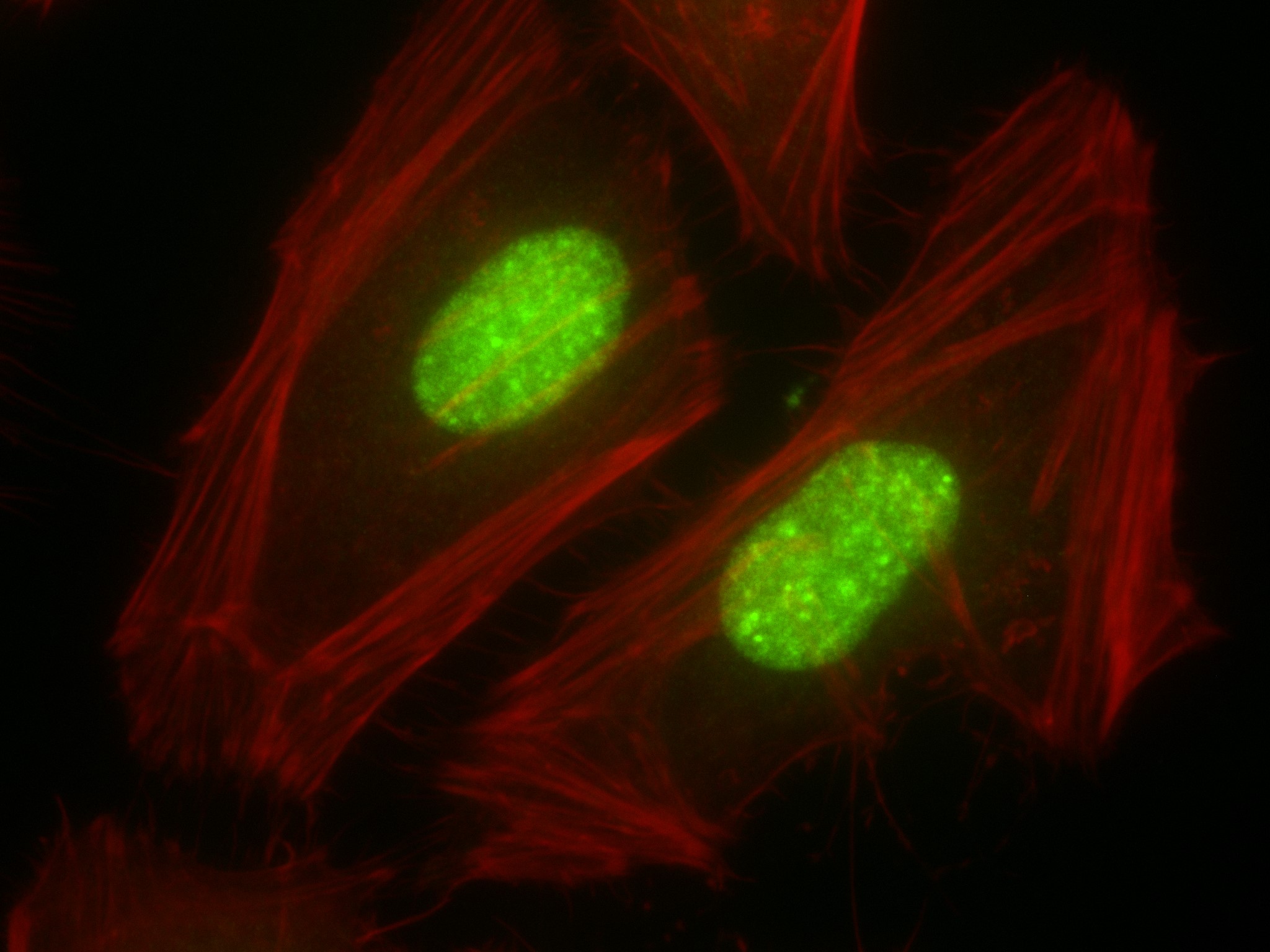 Immunofluorescence (IF) / fluorescent staining of HeLa cells using CSNK2A1 Recombinant antibody (83805-4-RR)