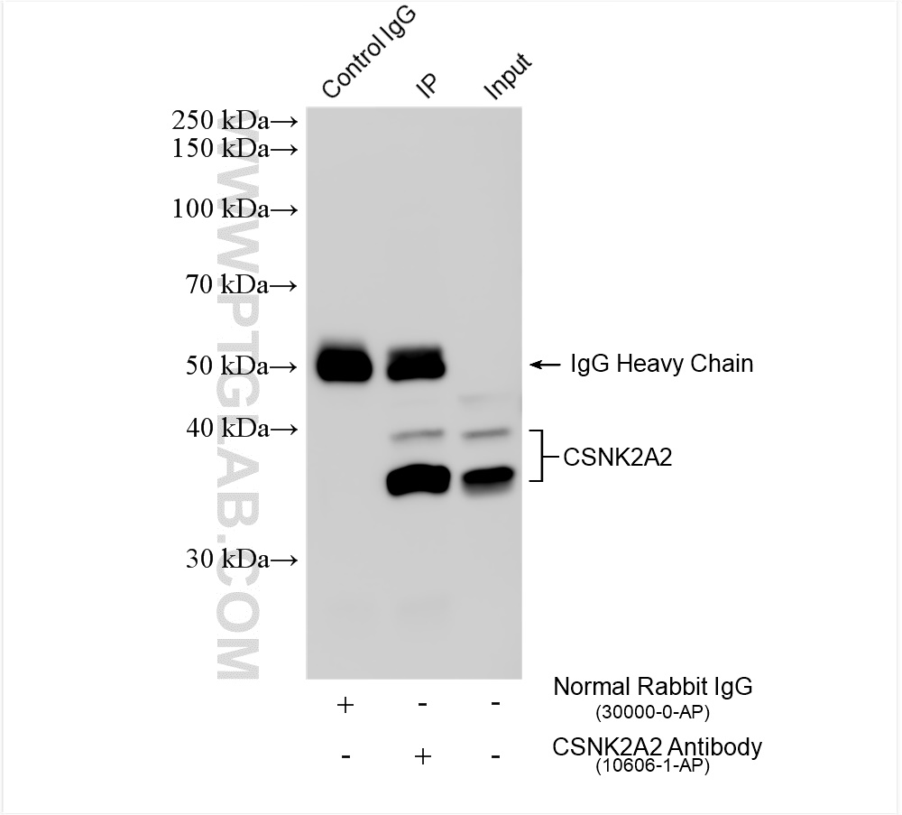 Immunoprecipitation (IP) experiment of Jurkat cells using CSNK2A2 Polyclonal antibody (10606-1-AP)