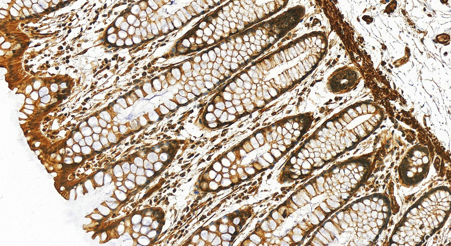 Immunohistochemistry (IHC) staining of human normal colon using CSRP1 Polyclonal antibody (13432-1-AP)