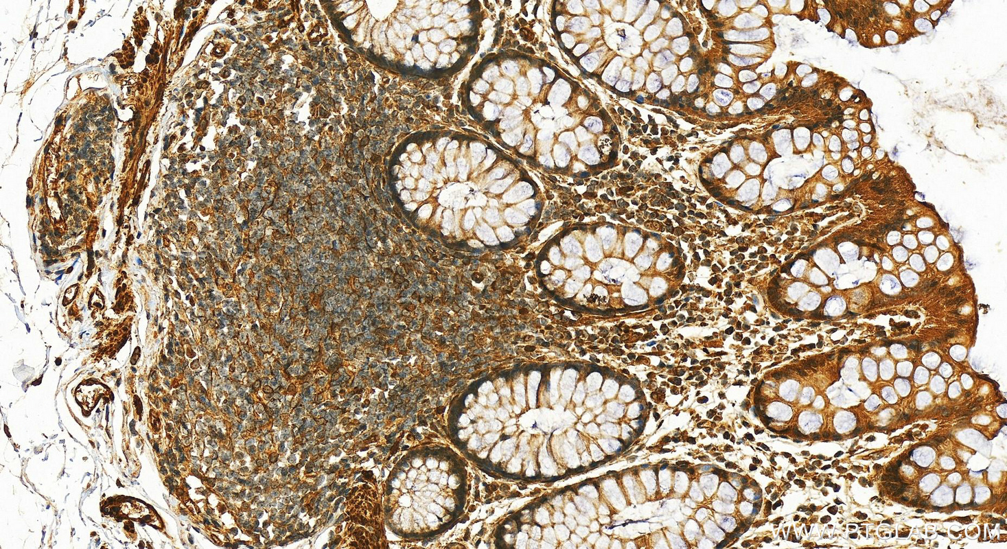 Immunohistochemistry (IHC) staining of human normal colon using CSRP1 Polyclonal antibody (13432-1-AP)