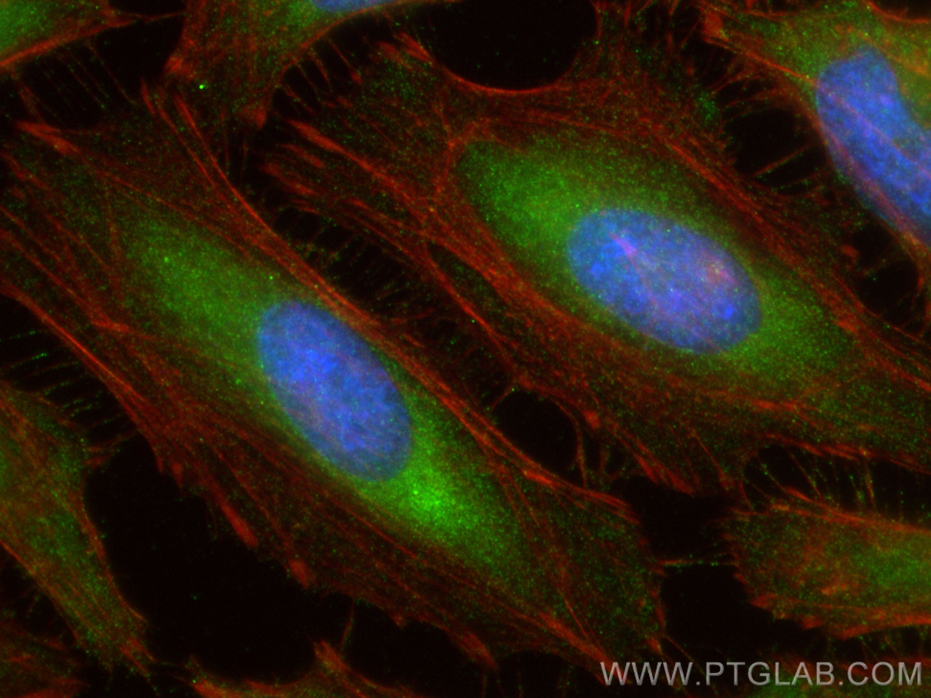 Immunofluorescence (IF) / fluorescent staining of HeLa cells using Cystatin C Polyclonal antibody (12245-1-AP)