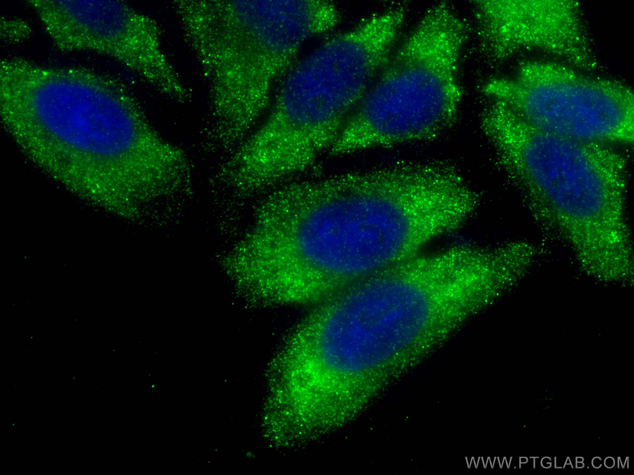 Immunofluorescence (IF) / fluorescent staining of HepG2 cells using Cystatin A Polyclonal antibody (15962-1-AP)