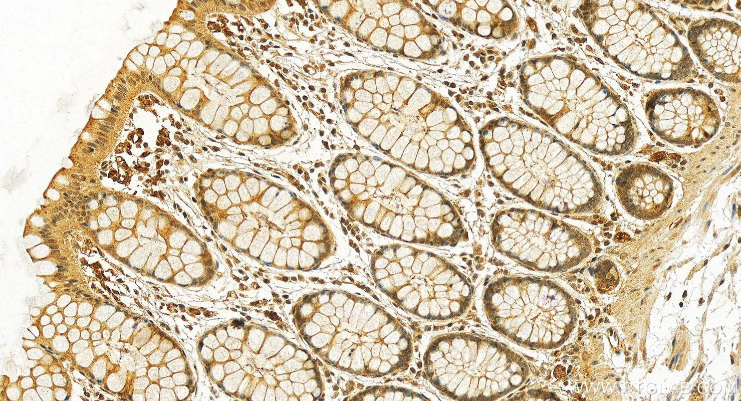 Immunohistochemistry (IHC) staining of human colon tissue using Cystatin B Polyclonal antibody (10823-1-AP)