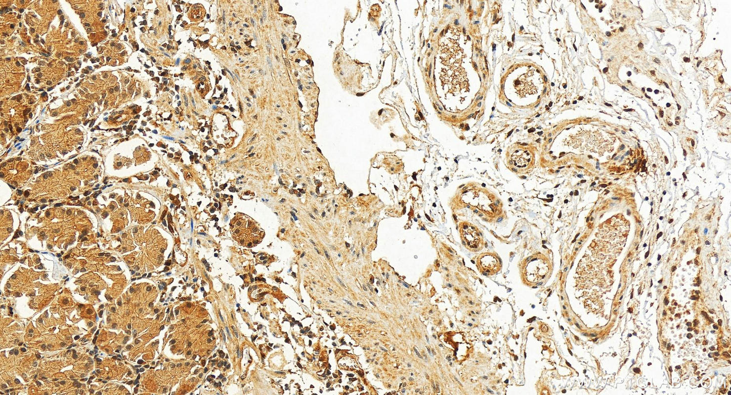 Immunohistochemistry (IHC) staining of human stomach tissue using Cystatin B Polyclonal antibody (10823-1-AP)