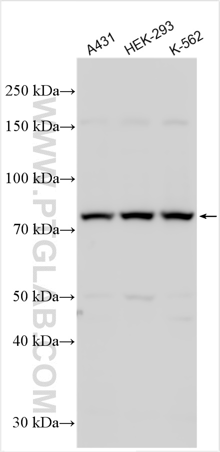 Western Blot (WB) analysis of various lysates using CSTF3 Polyclonal antibody (24290-1-AP)