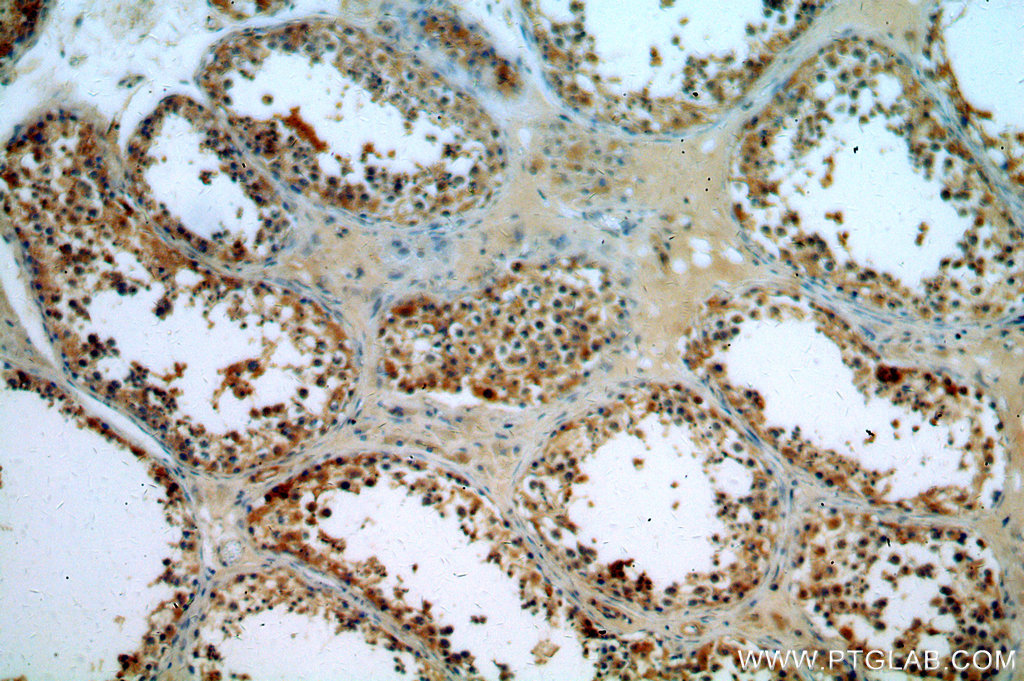 Immunohistochemistry (IHC) staining of human testis tissue using CSTL1-Specific Polyclonal antibody (20086-1-AP)