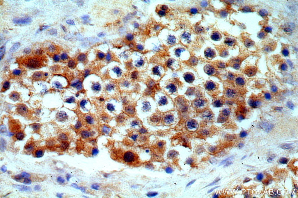 Immunohistochemistry (IHC) staining of human testis tissue using CSTL1-Specific Polyclonal antibody (20086-1-AP)