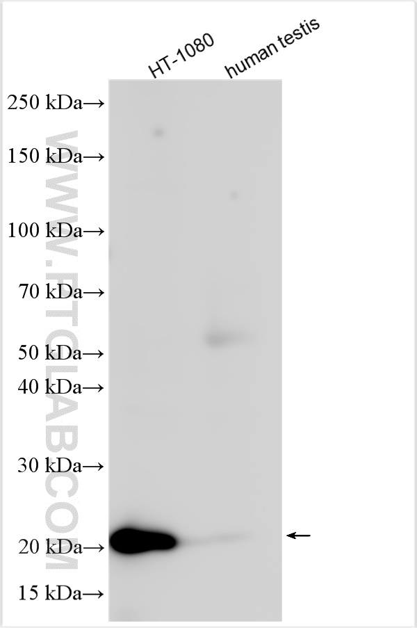 CTAG1B