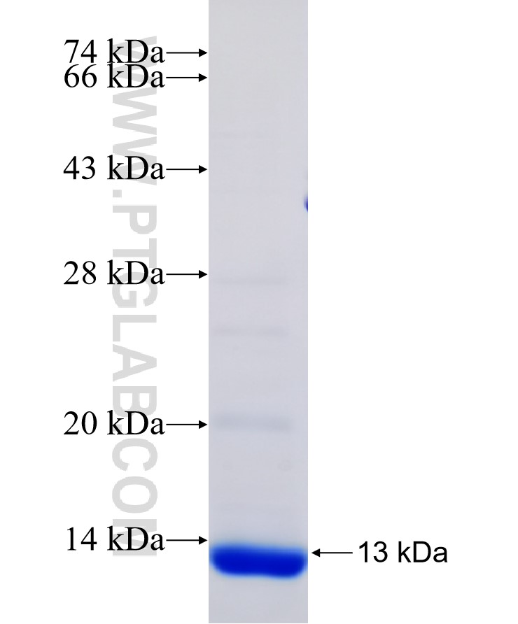 CTAG1B fusion protein Ag18967 SDS-PAGE