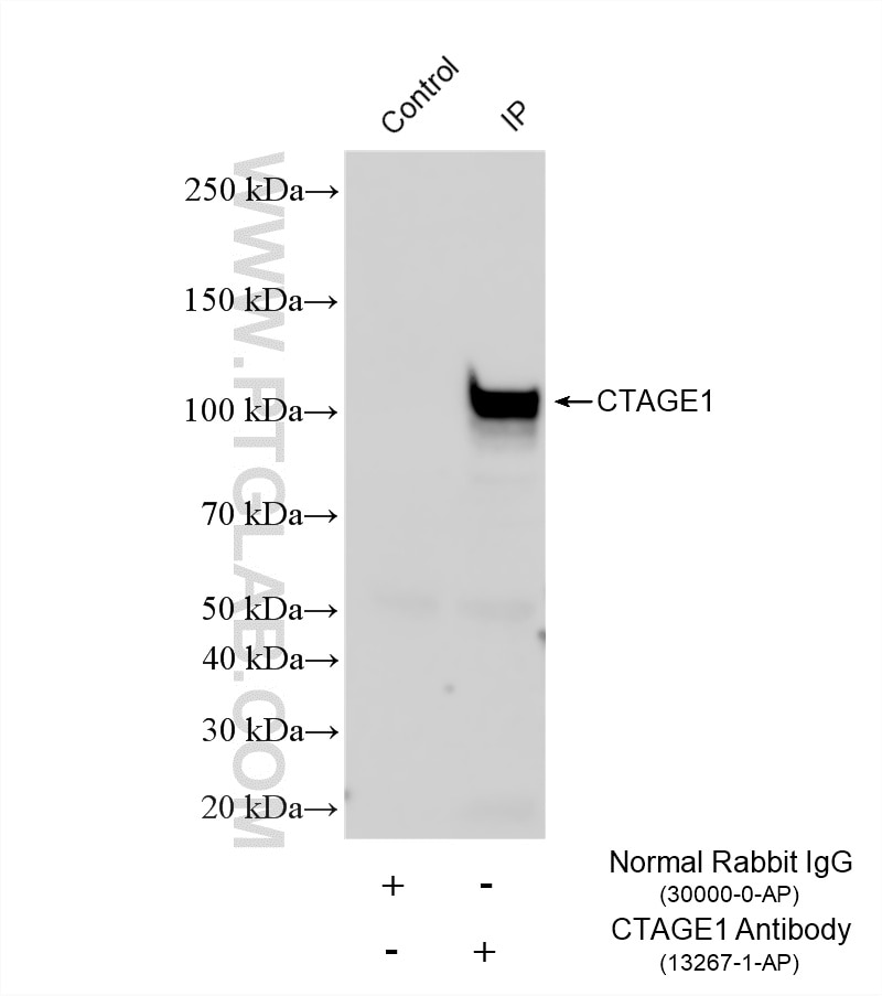 Immunoprecipitation (IP) experiment of HeLa cells using CTAGE1 Polyclonal antibody (13267-1-AP)