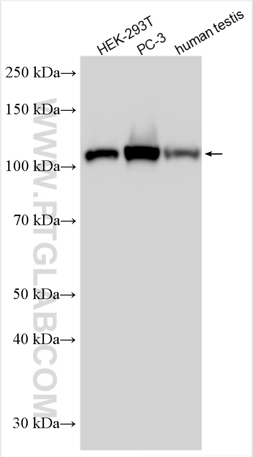 Western Blot (WB) analysis of various lysates using CTAGE5 Polyclonal antibody (55279-1-AP)