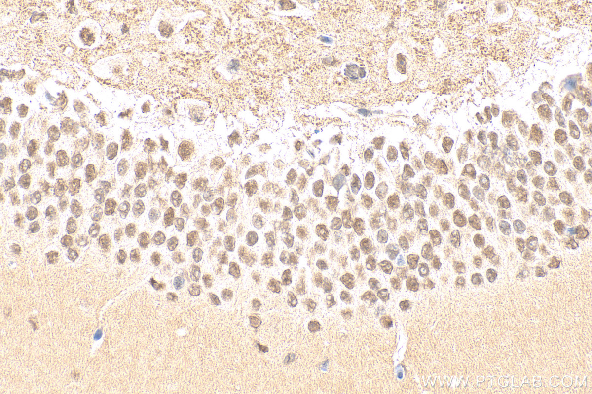 Immunohistochemistry (IHC) staining of mouse brain tissue using CTBP1 Polyclonal antibody (10972-1-AP)