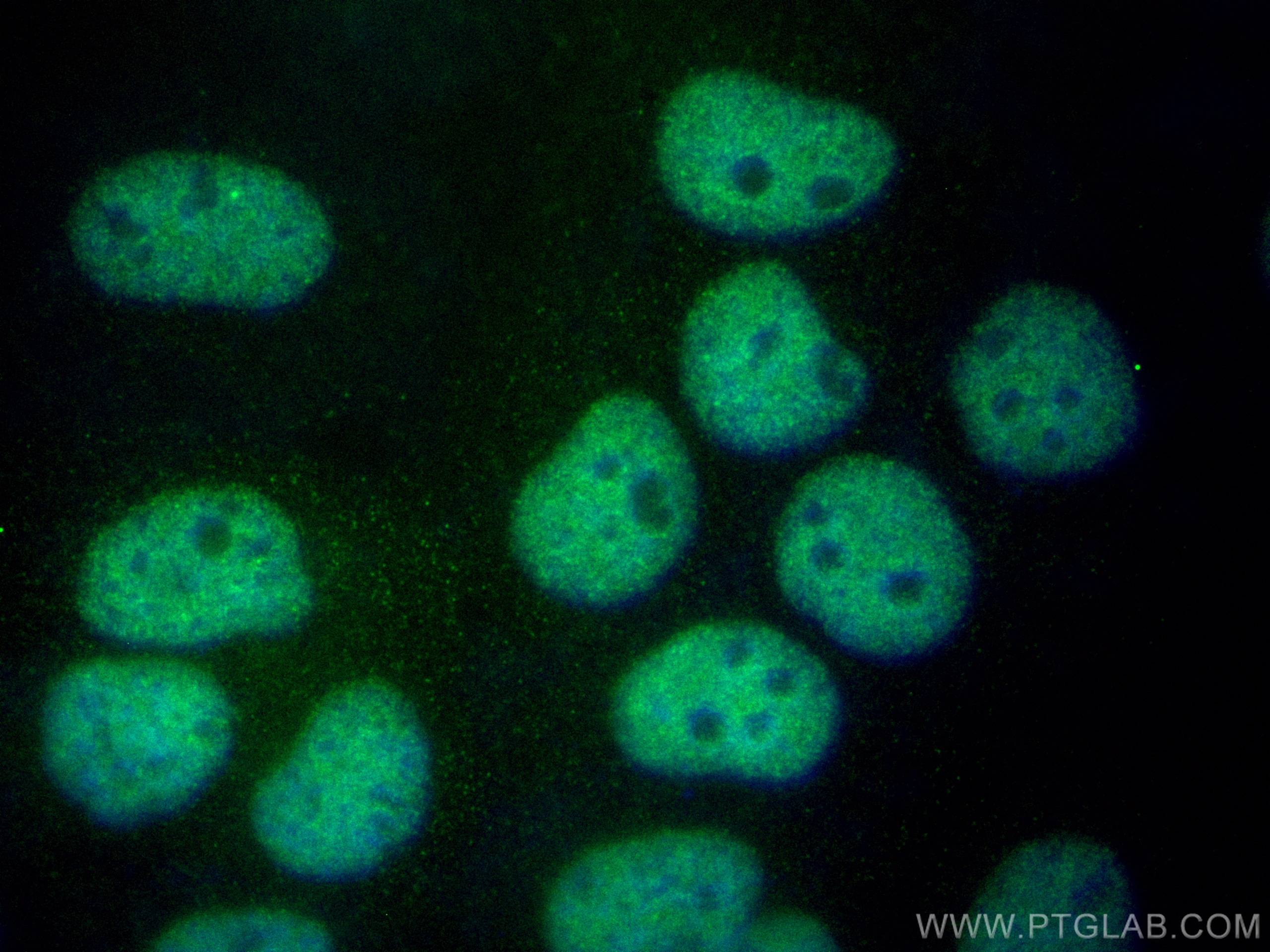 Immunofluorescence (IF) / fluorescent staining of A431 cells using CoraLite® Plus 488-conjugated CTBP1 Monoclonal ant (CL488-66995)