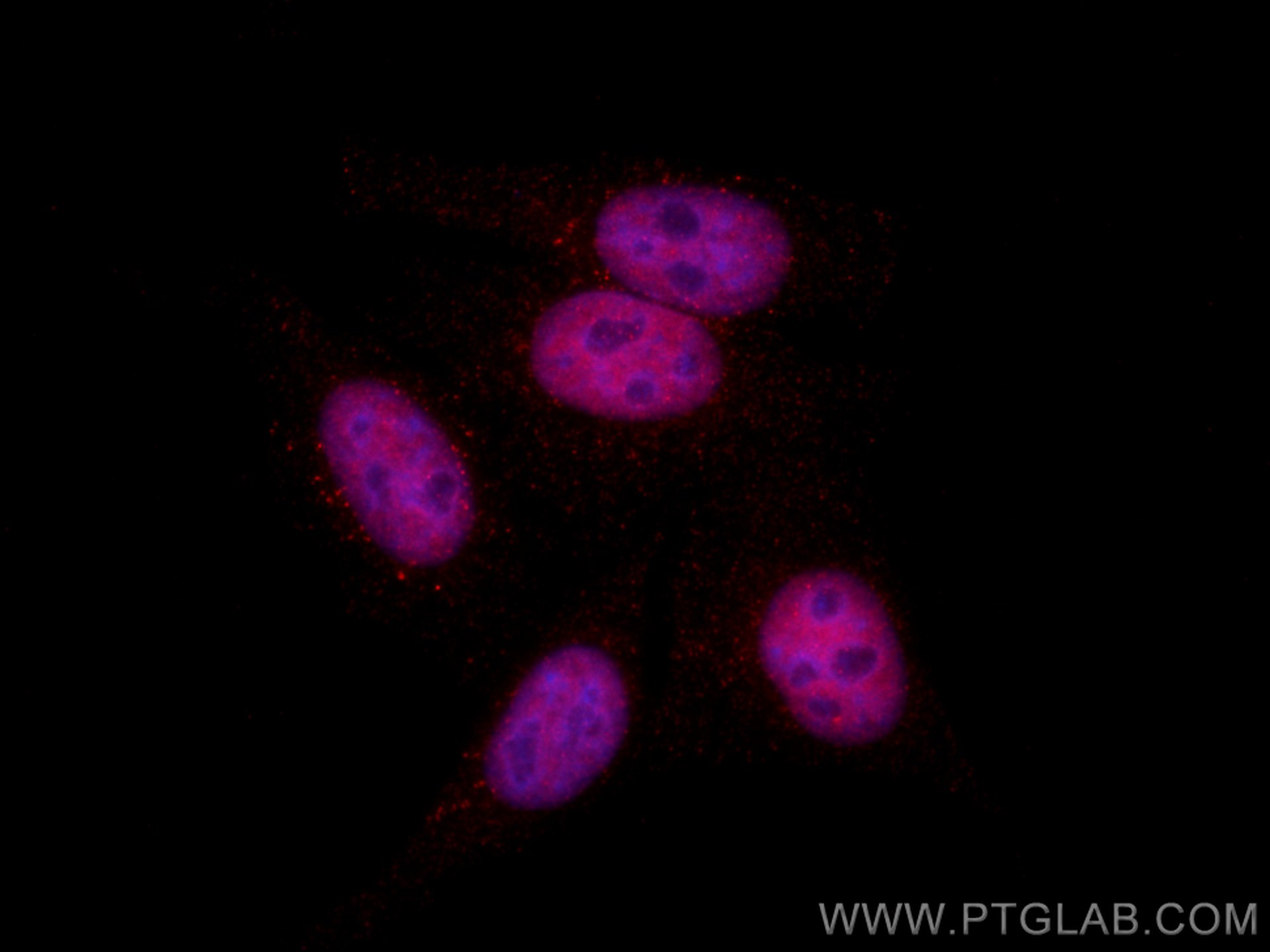 Immunofluorescence (IF) / fluorescent staining of HepG2 cells using CoraLite®594-conjugated CTBP1 Monoclonal antibody (CL594-66995)