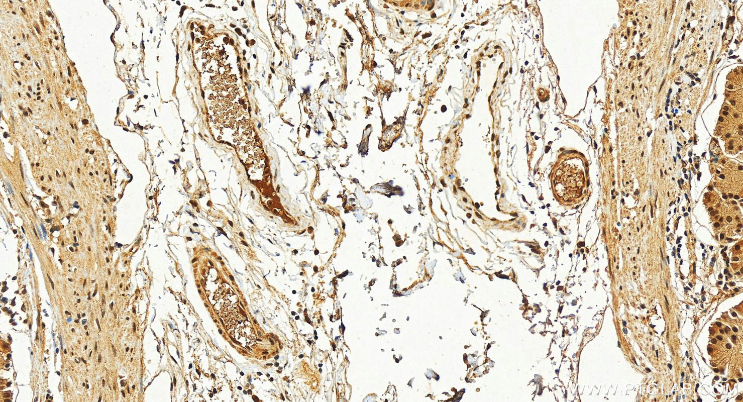 Immunohistochemistry (IHC) staining of human stomach tissue using CTBP2 Polyclonal antibody (10346-1-AP)