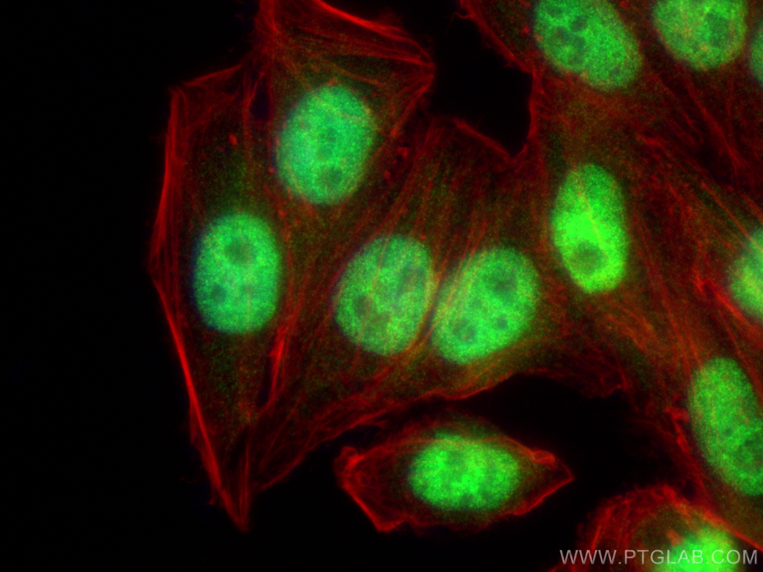 Immunofluorescence (IF) / fluorescent staining of HepG2 cells using CTCF Polyclonal antibody (30428-1-AP)