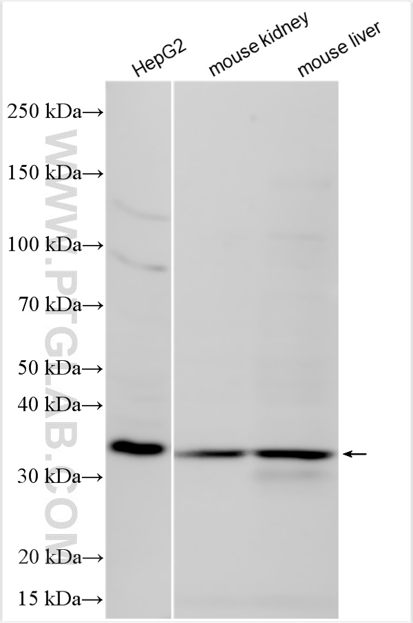 Western Blot (WB) analysis of various lysates using CTDSP1 Polyclonal antibody (10952-1-AP)