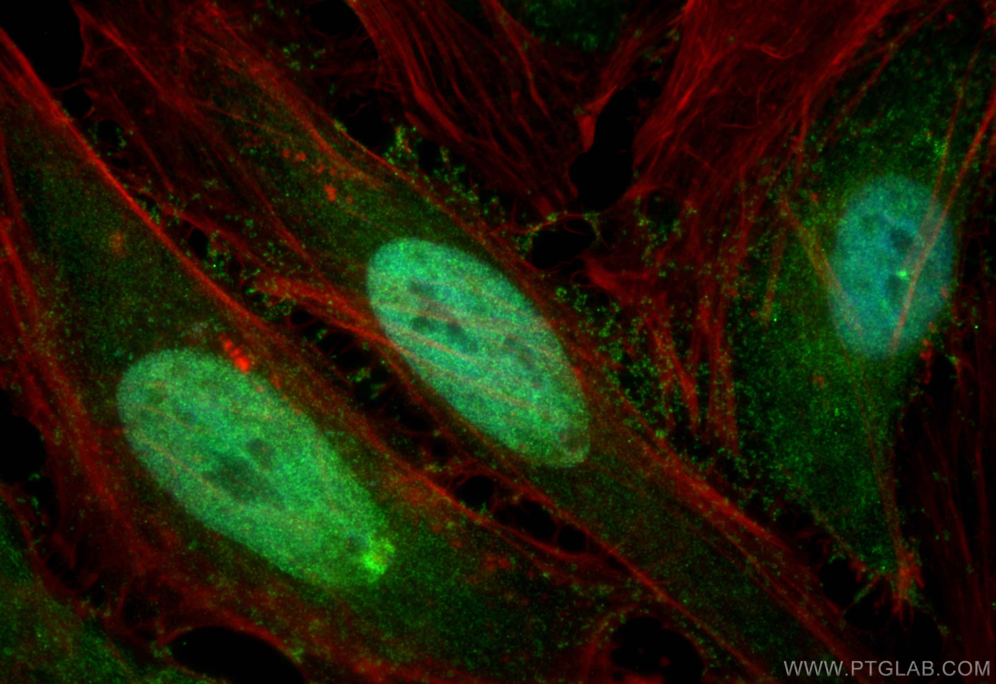 Immunofluorescence (IF) / fluorescent staining of HeLa cells using CTDSPL2 Polyclonal antibody (17532-1-AP)