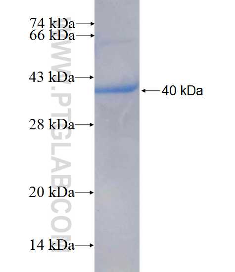 CTF1 fusion protein Ag26602 SDS-PAGE