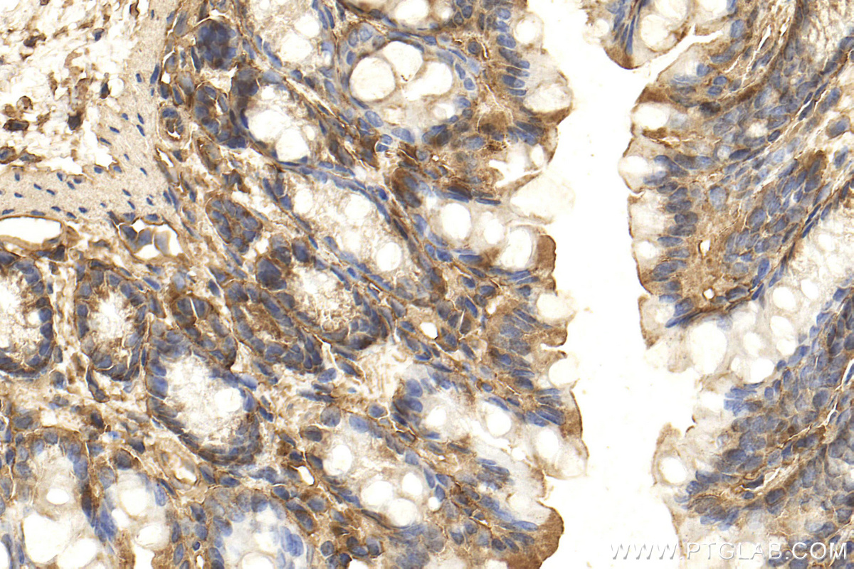 Immunohistochemistry (IHC) staining of mouse colon tissue using CTGF Polyclonal antibody (25474-1-AP)