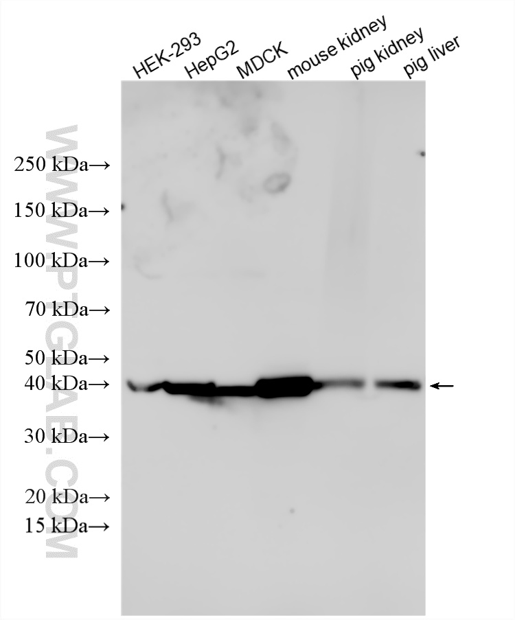 Western Blot (WB) analysis of various lysates using Gamma Cystathionase Polyclonal antibody (12217-1-AP)