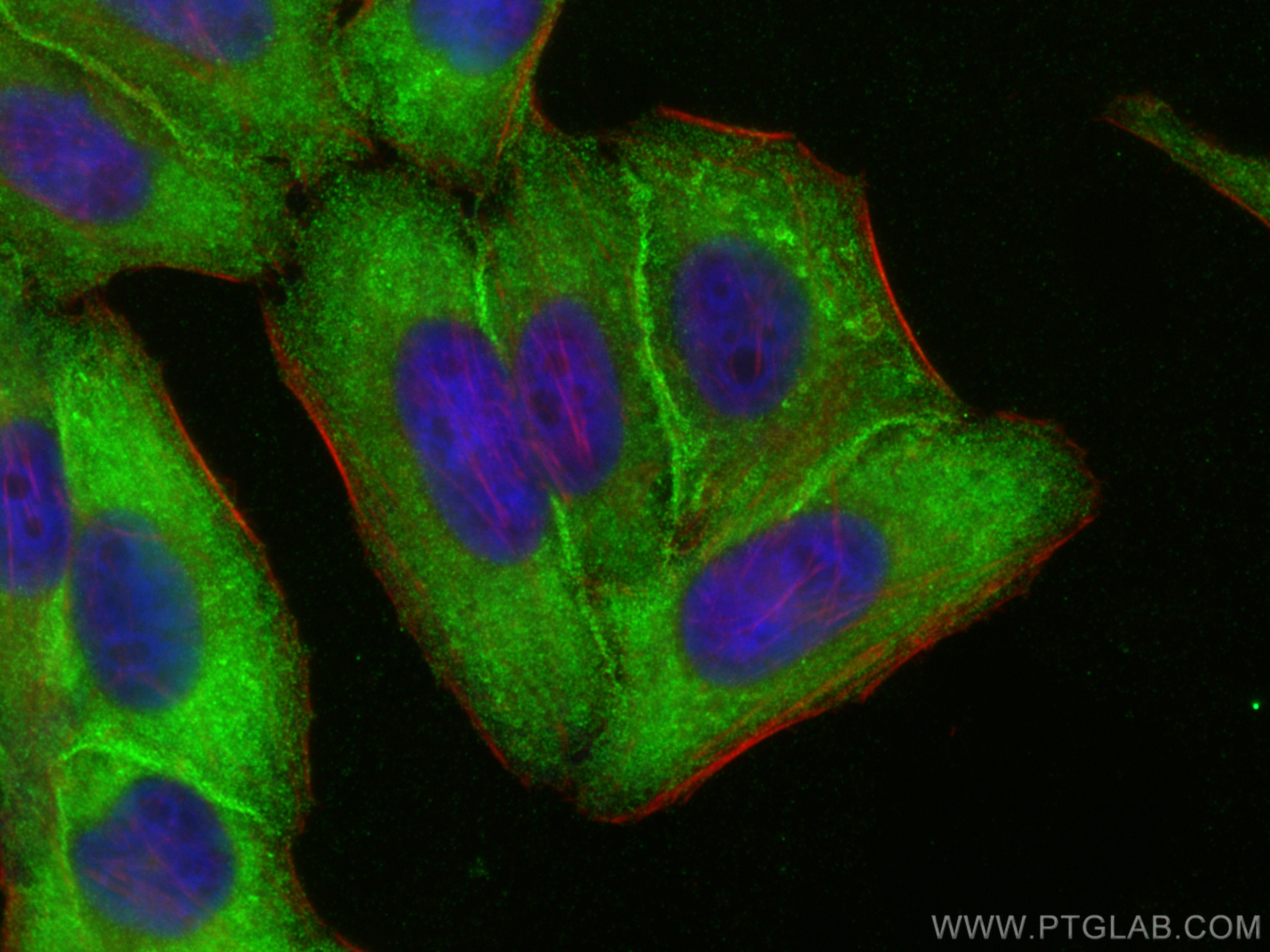 Immunofluorescence (IF) / fluorescent staining of HepG2 cells using CTHRC1 Polyclonal antibody (16534-1-AP)