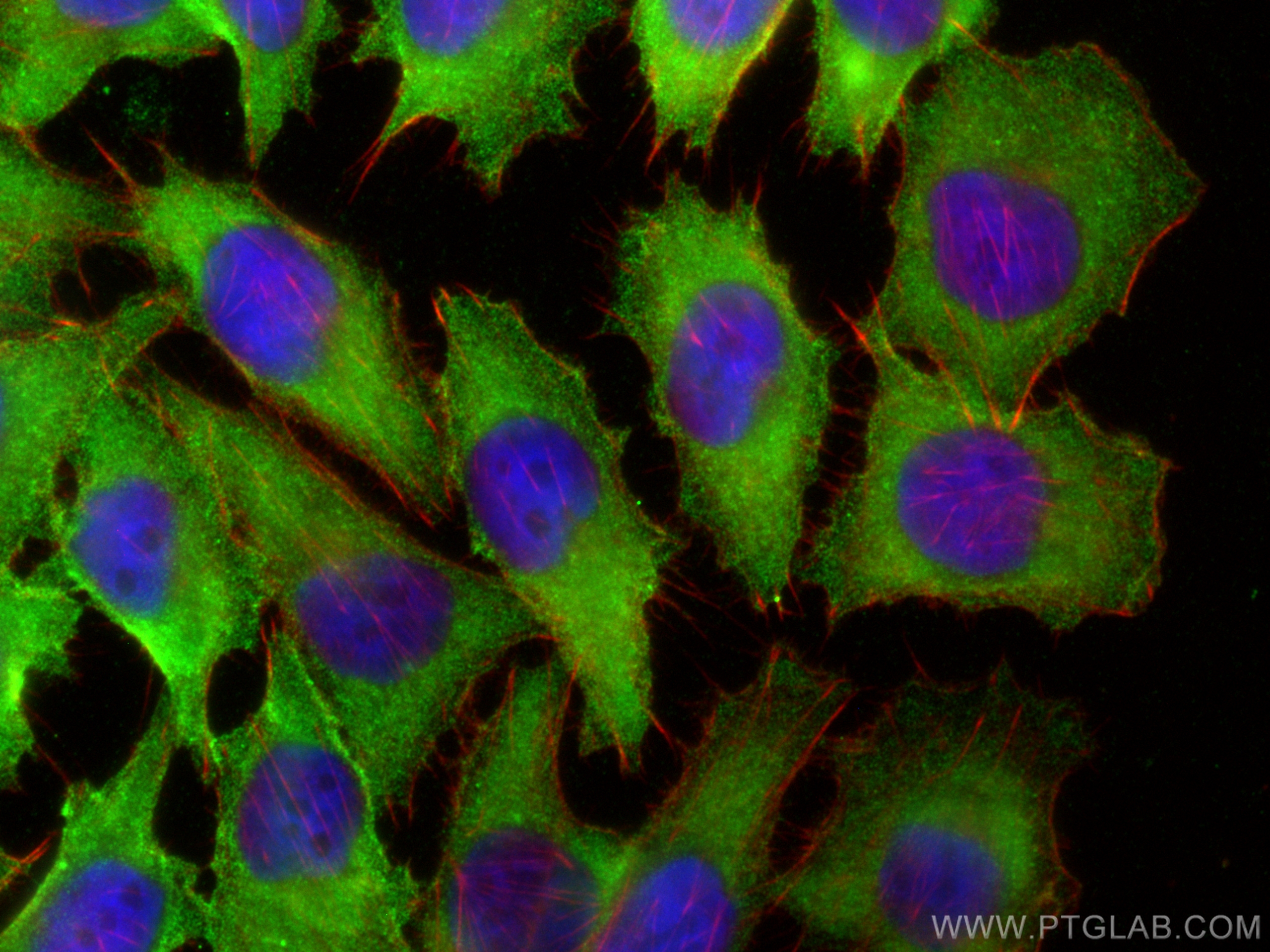 Immunofluorescence (IF) / fluorescent staining of A375 cells using CTHRC1 Polyclonal antibody (16534-1-AP)
