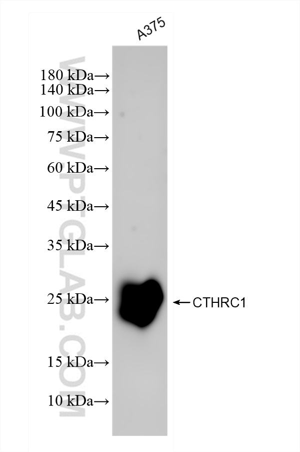 Western Blot (WB) analysis of A375 cells using CTHRC1 Recombinant antibody (83629-1-RR)