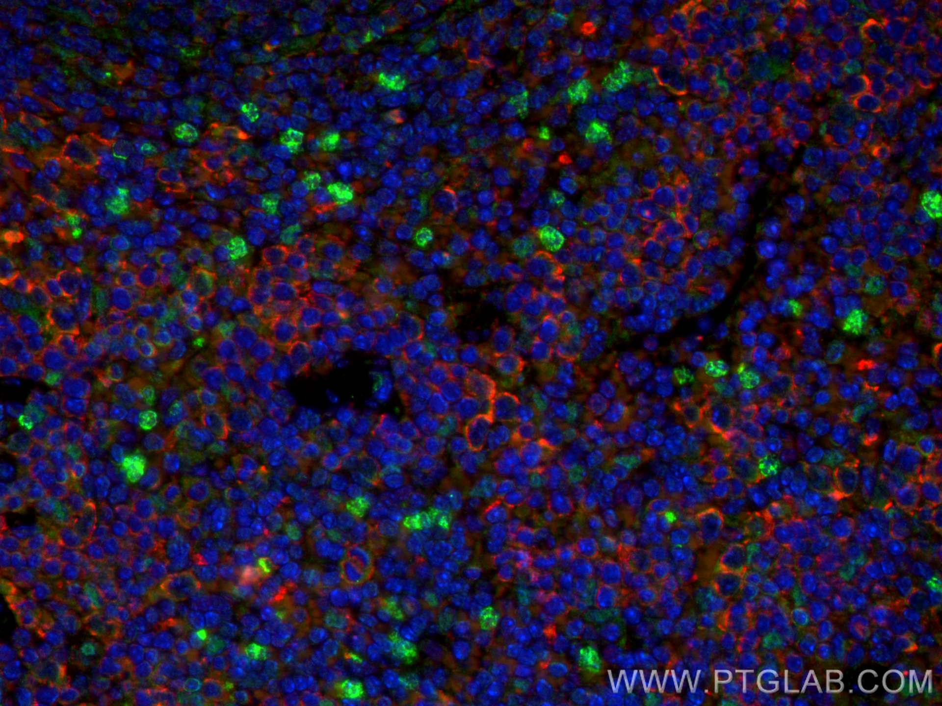 Immunofluorescence (IF) / fluorescent staining of mouse spleen tissue using CTLA-4 Polyclonal antibody (30648-1-AP)