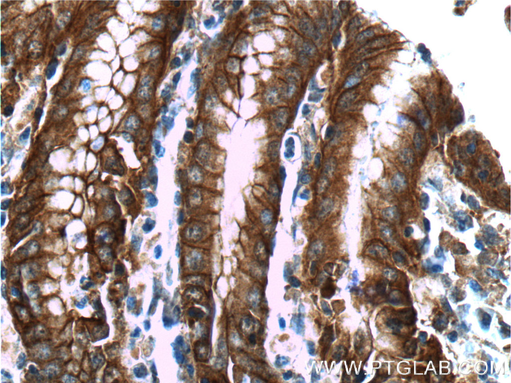 Immunohistochemistry (IHC) staining of human stomach tissue using Alpha E-Catenin Monoclonal antibody (66221-1-Ig)