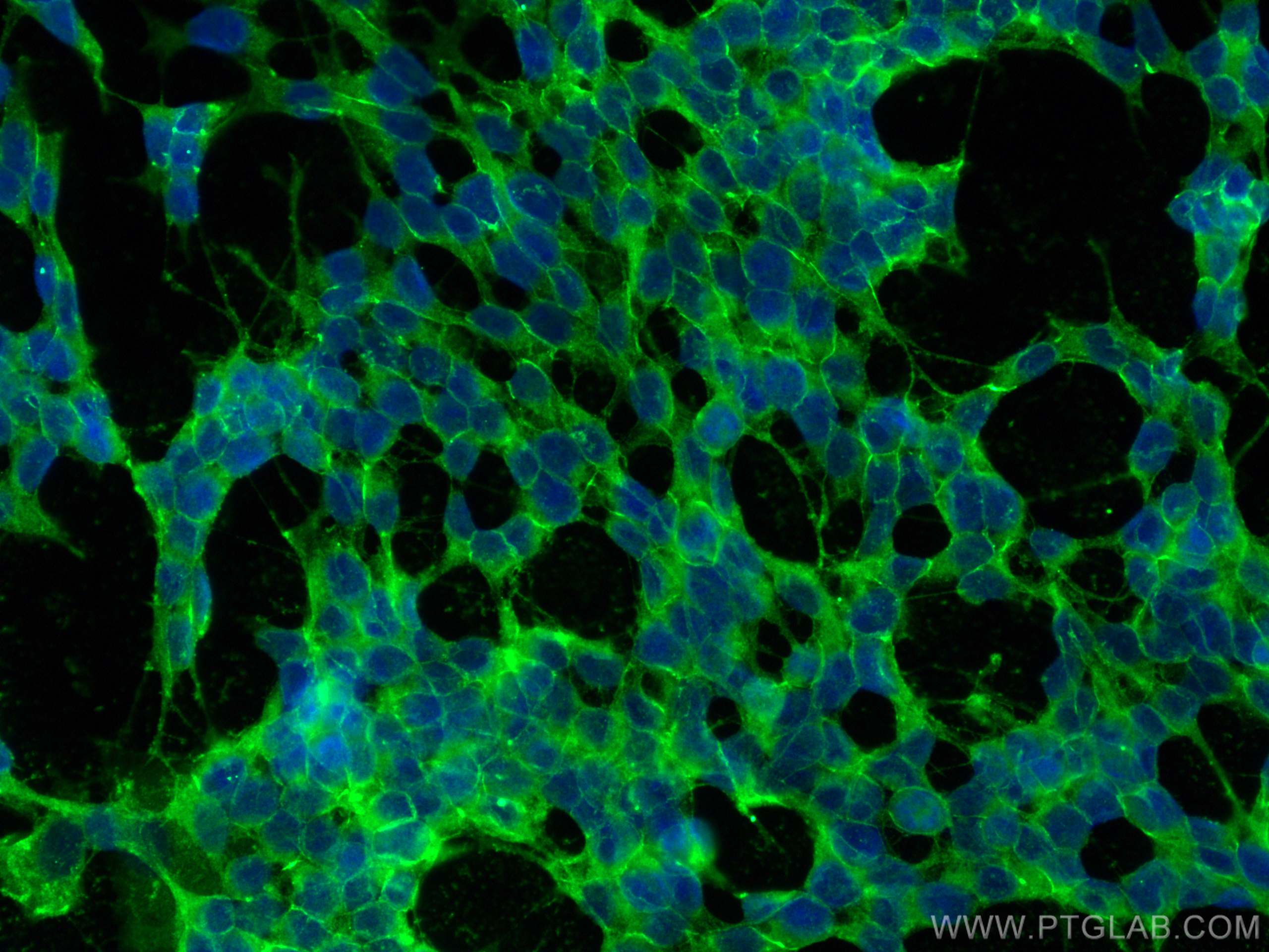 Immunofluorescence (IF) / fluorescent staining of SH-SY5Y cells using Alpha N-Catenin Polyclonal antibody (14362-1-AP)