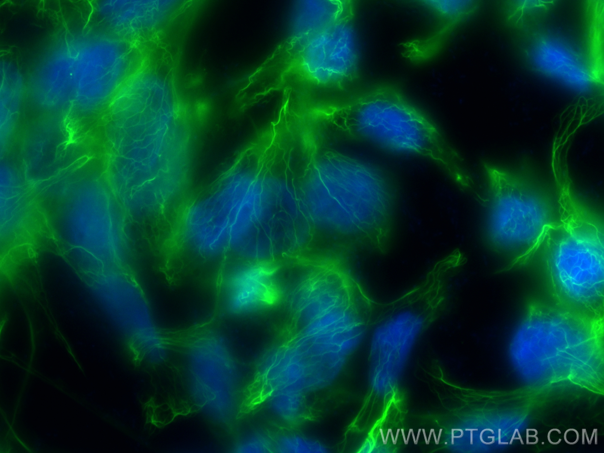 Immunofluorescence (IF) / fluorescent staining of LNCaP cells using CoraLite® Plus 488-conjugated CTNNAL1 Recombinant  (CL488-84052)