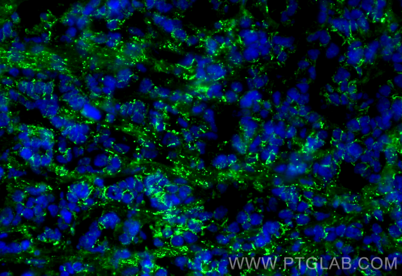 Immunofluorescence (IF) / fluorescent staining of mouse breast cancer using p120 Catenin Monoclonal antibody (66208-1-Ig)