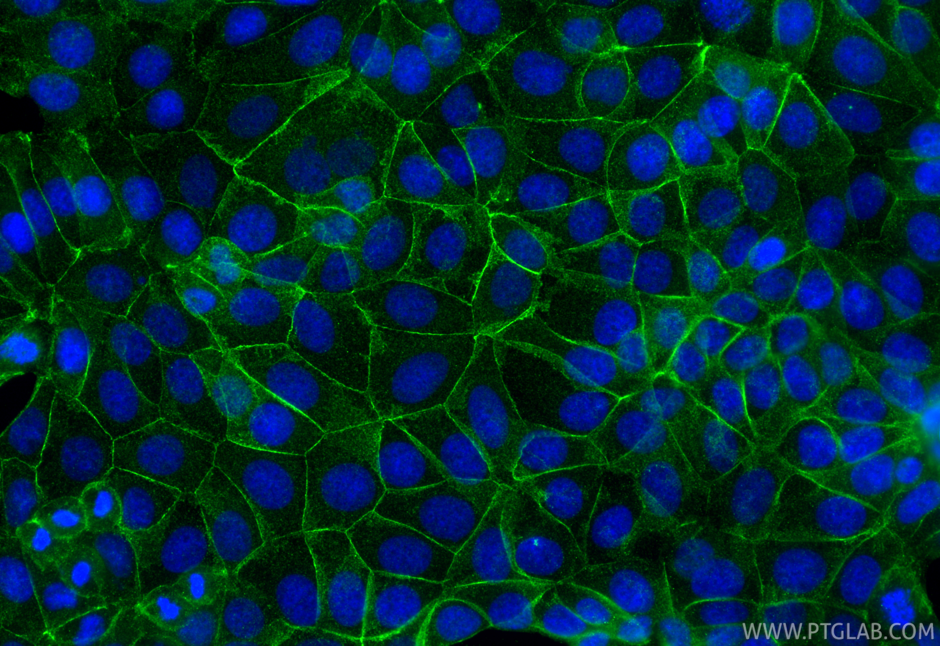 Immunofluorescence (IF) / fluorescent staining of MCF-7 cells using p120 Catenin Monoclonal antibody (66208-1-Ig)