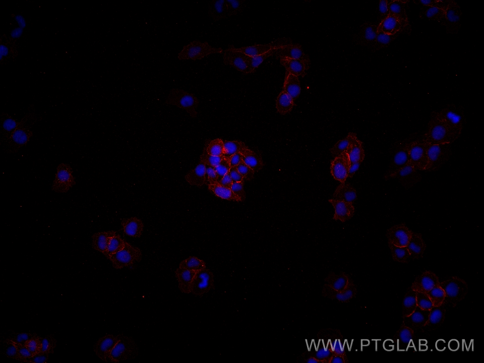 Immunofluorescence (IF) / fluorescent staining of A431 cells using p120 Catenin Monoclonal antibody (66208-1-Ig)