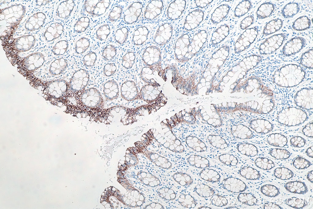 Immunohistochemistry (IHC) staining of human colon tissue using p120 Catenin Monoclonal antibody (66208-1-Ig)