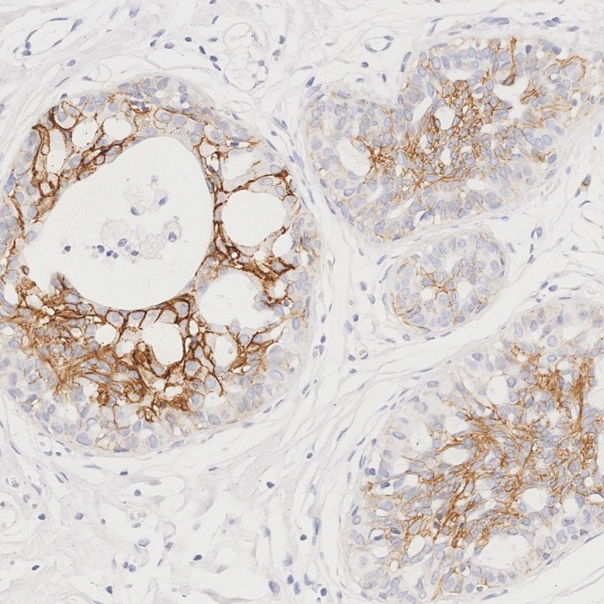 Immunohistochemistry (IHC) staining of human breast tissue using p120 Catenin Monoclonal antibody (66208-1-Ig)