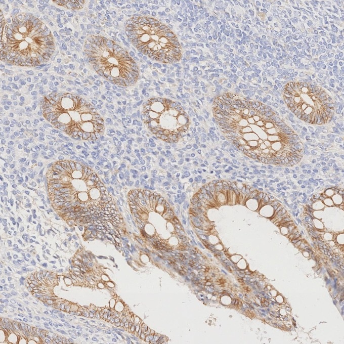Immunohistochemistry (IHC) staining of human appendicitis tissue using p120 Catenin Monoclonal antibody (66208-1-Ig)
