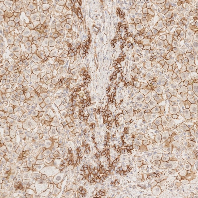 Immunohistochemistry (IHC) staining of human liver tissue using p120 Catenin Monoclonal antibody (66208-1-Ig)