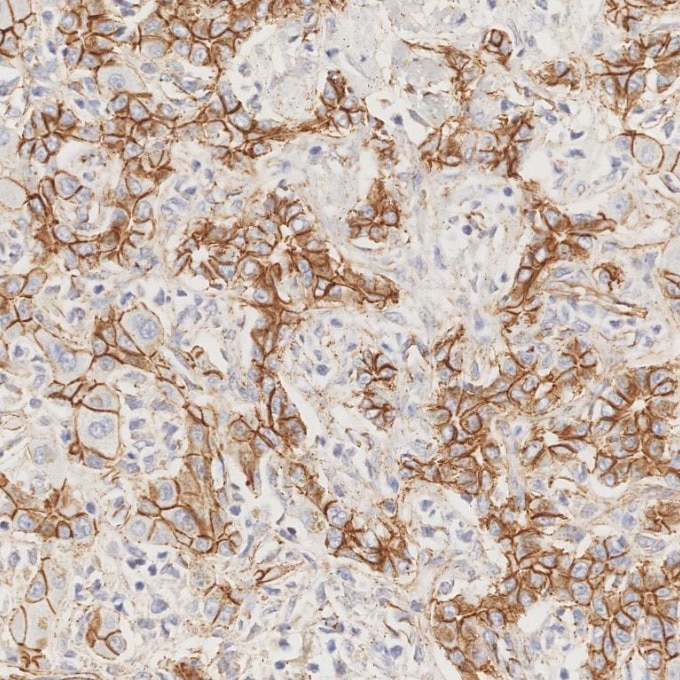 Immunohistochemistry (IHC) staining of human liver tissue using p120 Catenin Monoclonal antibody (66208-1-Ig)
