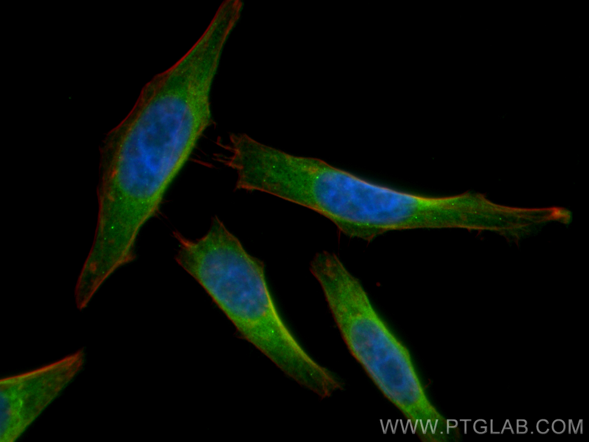 Immunofluorescence (IF) / fluorescent staining of HepG2 cells using CTP synthase Polyclonal antibody (15914-1-AP)