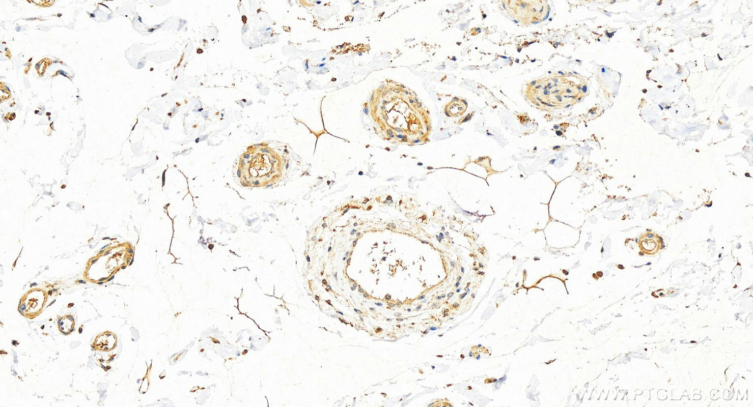 Immunohistochemistry (IHC) staining of human colon tissue using CTPS2 Polyclonal antibody (12852-1-AP)