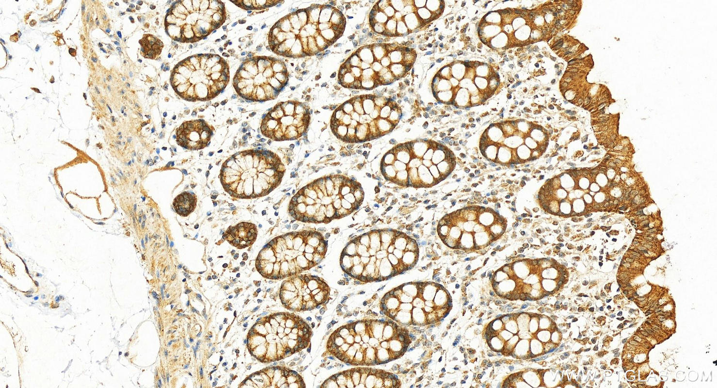 Immunohistochemistry (IHC) staining of human colon tissue using CTPS2 Polyclonal antibody (12852-1-AP)