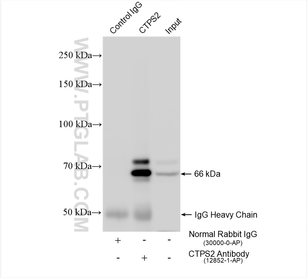 Immunoprecipitation (IP) experiment of HeLa cells using CTPS2 Polyclonal antibody (12852-1-AP)